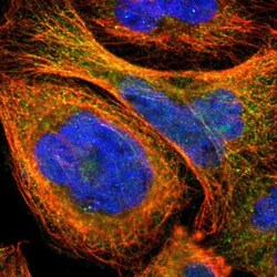 ZNF96 Antibody, Novus Biologicals 0.1mL; Unlabeled:Antibodies, Polyclonal